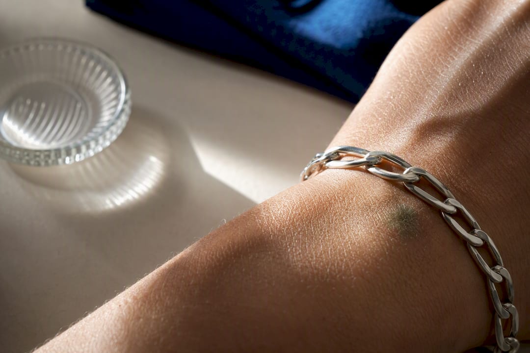 Partial silver chain beside green skin mark